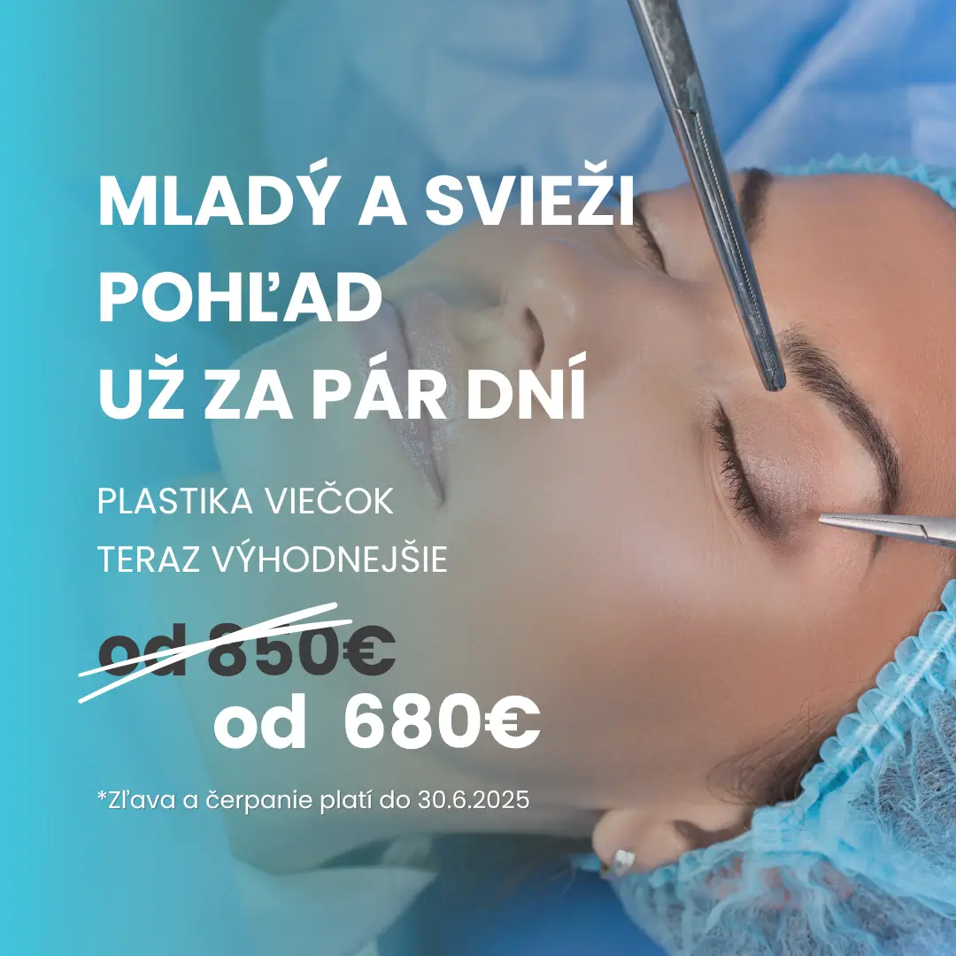 Plastika viečok